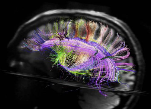 Diffusion Tensor Image of human Brains Connections 
