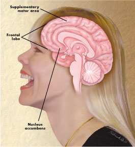 Nucleus accumbens und linker Stirnlappen, während wir lachen