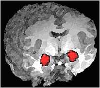 Unsere Mandelkerne (Amygdala), © 2002 by NIH/NIMH, USA