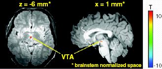 Zwei funktionelle Magnetresonanz-Tomografie-Aufnahmen vom VTA, © Kimberlee D'Ardenne, Science, 2008